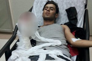Karakola atacağı patlayıcı elinde patladı