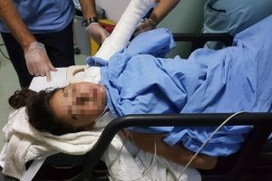 6. kattan d&uuml;şen &ccedil;ocuk &ouml;l&uuml;mden d&ouml;nd&uuml;