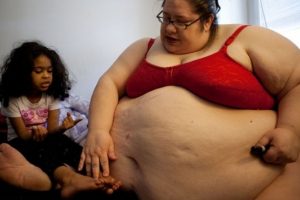 D&uuml;nyanın &uuml;&ccedil;te biri obez olma yolunda