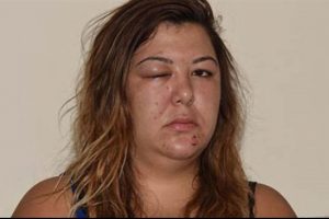 Tanışma teklifini reddeden kadının darbedildiği iddiasıyla g&ouml;zaltına alınan 2 kişi serbest