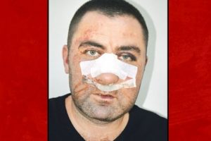 'Trabzonspor eski yöneticisi 8 saat işkence yaptı' iddiası