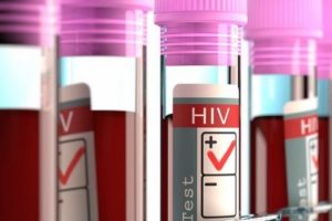 İngilizler AIDS'li hastayı iyileştirdi