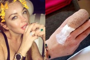 Lindsay Lohan'ın kopan parmağı yerine dikildi