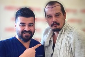 Arda Kural sa&ccedil; ektirdi