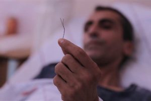 Bağırsağından 10 santimlik tel &ccedil;ıktı