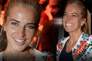 Burcu Esmersoy'un sa&ccedil;ları beyazladı