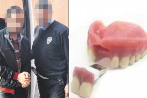Takma dişin i&ccedil;inden &ccedil;ıktı! G&ouml;ren şok oldu...