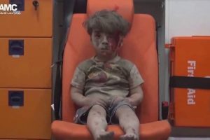 Suriyeli &Uuml;mran bebek ağır yaralı