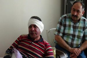 Sendika yetkilisi feci şekilde darp edildi