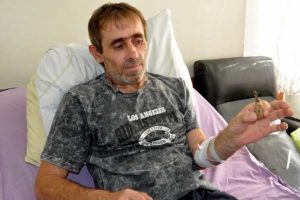 İdrar kesesinden 8 santimlik odun par&ccedil;ası &ccedil;ıktı