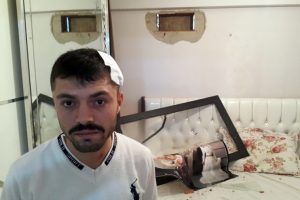 İstanbul'da ilgin&ccedil; olay: Uyurken kafasına tuğla d&uuml;şt&uuml;