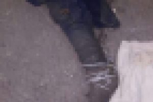 &Ccedil;&ouml;pten &ccedil;ıkan bacağın sırrını kayıp başvuruları &ccedil;&ouml;zecek