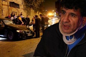 İstanbul'da l&uuml;ks otomobil yakıt tankerine &ccedil;arptı: 1 yaralı