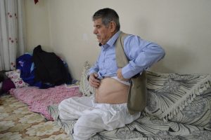 45 yıllık sigara bağımlısının ibretlik hikayesi