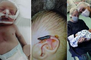 Kulağı kopan bebek skandalında ikinci perde