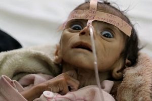 Yemen'den korkutan haber!