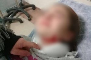 K&ouml;peklerin saldırısına uğrayan &ccedil;ocuk &ouml;l&uuml;mden d&ouml;nd&uuml;