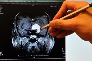 Beynin y&uuml;z tanıma merkezi yetişkinlikte de b&uuml;y&uuml;yor