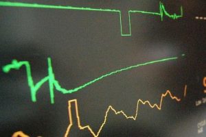 Aşırı stres kalbi vuruyor