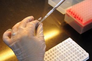 Kanserin yayılması y&uuml;zde 75 engellendi