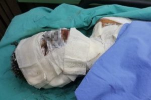 Sobaya d&ouml;k&uuml;len tiner hastanelik etti