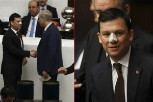 Burnu kırılan AK Partili Fatih Şahin konuştu