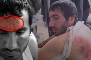 Alında bot izi &ccedil;ıkartan şiddet i&ccedil;in Yargıtay'dan &ouml;nemli karar