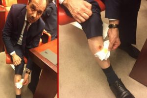 Ayağı ısırılan Muhammet Balta'nın şikayeti &uuml;zerine soruşturma başlatıldı