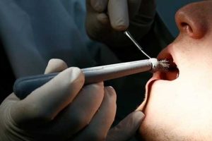 Ağız kanserine karşı 'T&uuml;rk fır&ccedil;ası'yla m&uuml;cadele