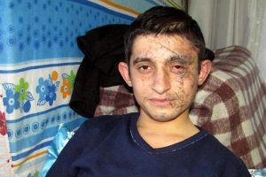 Kayseri'deki ter&ouml;r saldırısında yaralanan er yaşadıklarını anlattı