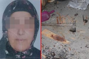 Eşini defalarca bı&ccedil;aklayıp kolunu kırdı