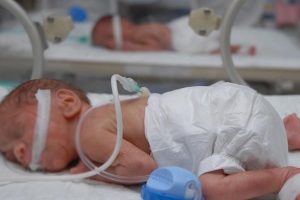 İkiz bebekler 'farklı yıllarda' d&uuml;nyaya geldi