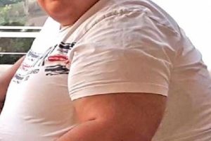 İskenderunlu gen&ccedil; 8 ayda 78 kilo verdi