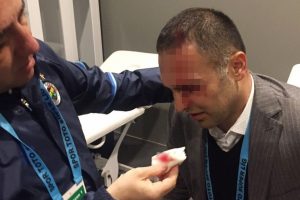 Fenerbah&ccedil;e'den a&ccedil;ıklama geldi