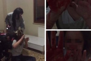 Gen&ccedil; kızların burun kırmalı kavgası!