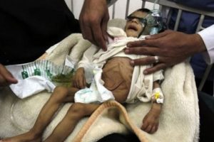 Yemen'de cenaze t&ouml;renine saldırı!