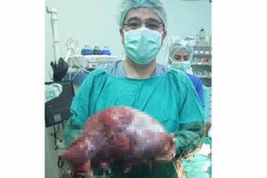 10 kiloluk kitle karnından &ccedil;ıktı