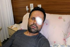 Adıyaman'da &ccedil;orbayı beğenmediği i&ccedil;in garsonu k&ouml;r etti