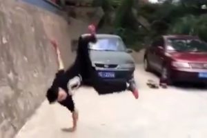 Takla atmak isterken kolunu kırdı