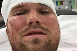 Grosskreutz'u d&ouml;ven T&uuml;rk &ccedil;ıktı