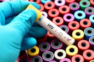 AYM'den AIDS'li iş&ccedil;iye tazminat kararı