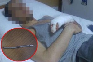 'Tespih' zannettiği n&uuml;kleer madde hayatını kararttı