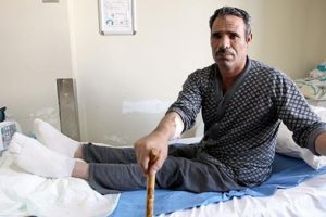 Tandırda ayaklarını yaktı ama fark etmedi!