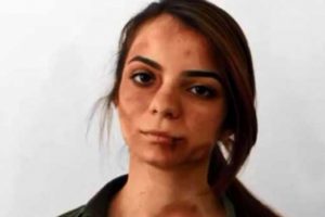 Onlarca insan g&ouml;rmemezlikten geldi!