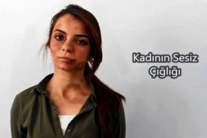 Bu hale getirildi ama kimse d&ouml;n&uuml;p bakmadı