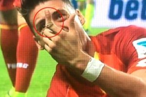Hoffenheimlı futbolcunun parmağı ortadan ikiye kırıldı