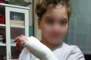 Cetvelle &ouml;ğrencisinin elini kıran &ouml;ğretmenin cezası belli oldu