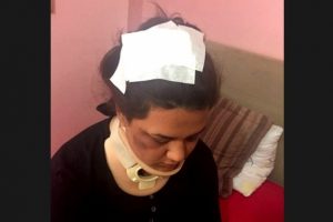 'Hatalı evet oyuna itiraz ettim saldırdılar' iddiası