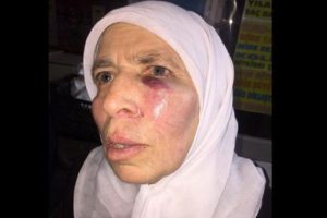 Yaşlı kadına yumruklu saldırı