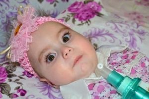 Zeynep bebeğin y&uuml;rek burkan dramı
